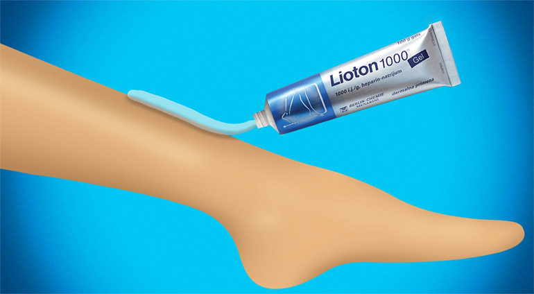 Nanošenje Lioton 1000® gela na teške noge